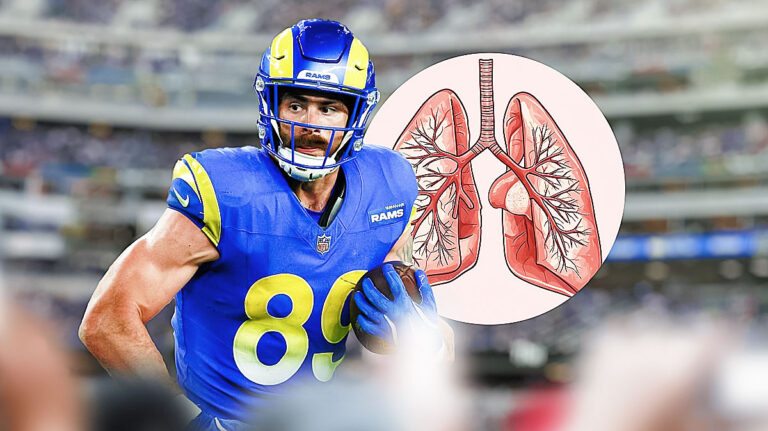 Rams’ Tyler Higbee was spitting blood after the win against the Vikings